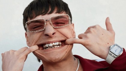 靠 LADY GAGA 全球爆火，他居然变帅了！