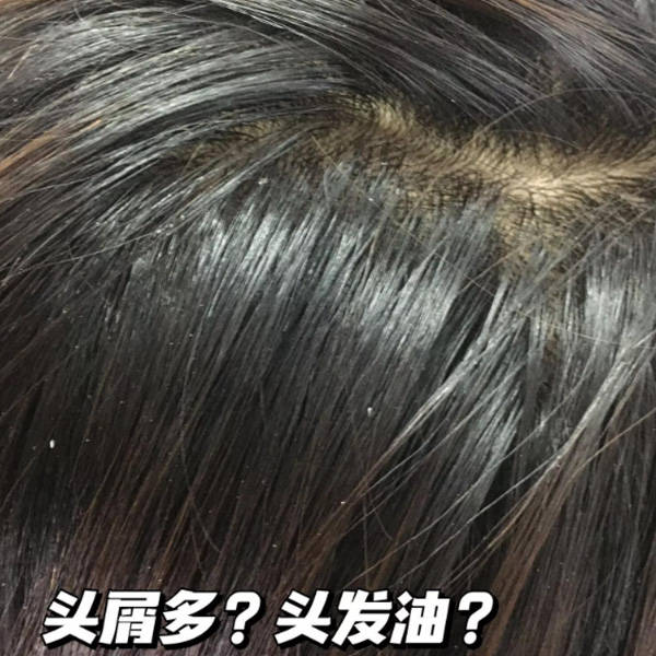 洗发水去屑止痒清爽控油?比较火的洗发水推荐