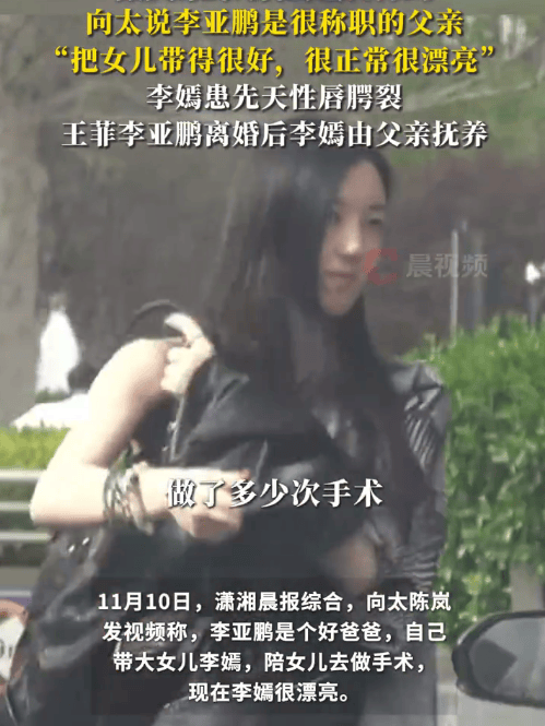 向太说李亚鹏是个好爸爸：他自己带大女儿李嫣还陪她做手术